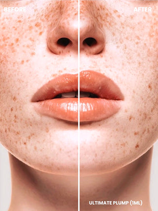 ULTIMATE PLUMP (1ML)